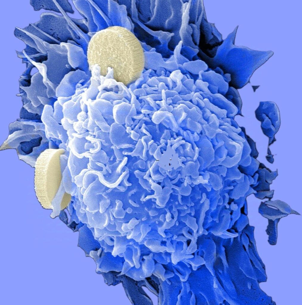 Genetic Mapping Study Reveals Four Key Categories of Cancer Drug Resistance Mutations