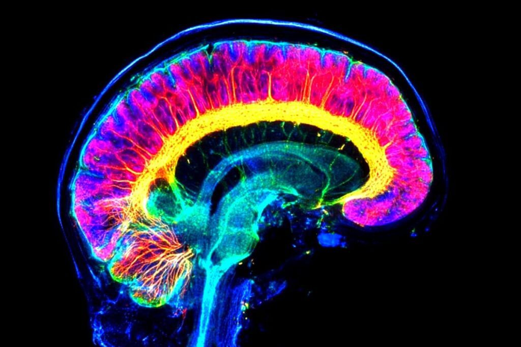 How Adult Neurogenesis Boosts Verbal Learning and Memory