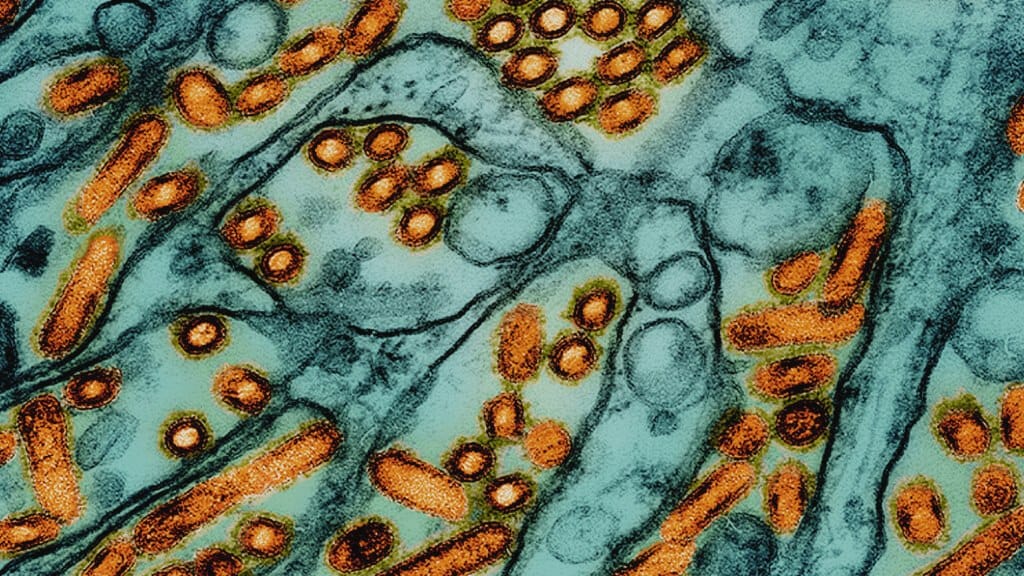 Bird Flu Mutations Found in Louisiana Patient Spark Fresh Concerns