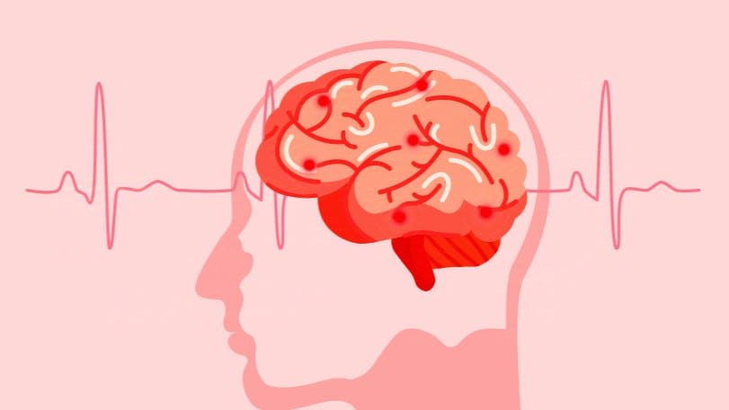 Type 3 Diabetes: Exploring Its Causes, Symptoms, and Potential Treatments