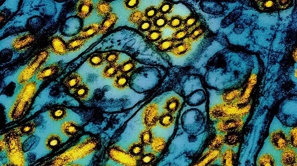 Is Bird Flu the Next Pandemic? Key Facts About H5N1 in the US