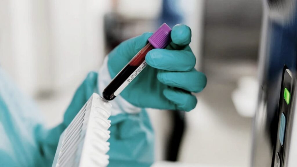 Understanding Genetic Testing for Cancer: Who Should Consider It and Why