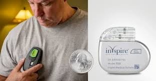 Inspire Sleep Apnea: A Breakthrough in Sleep Disorder Treatment