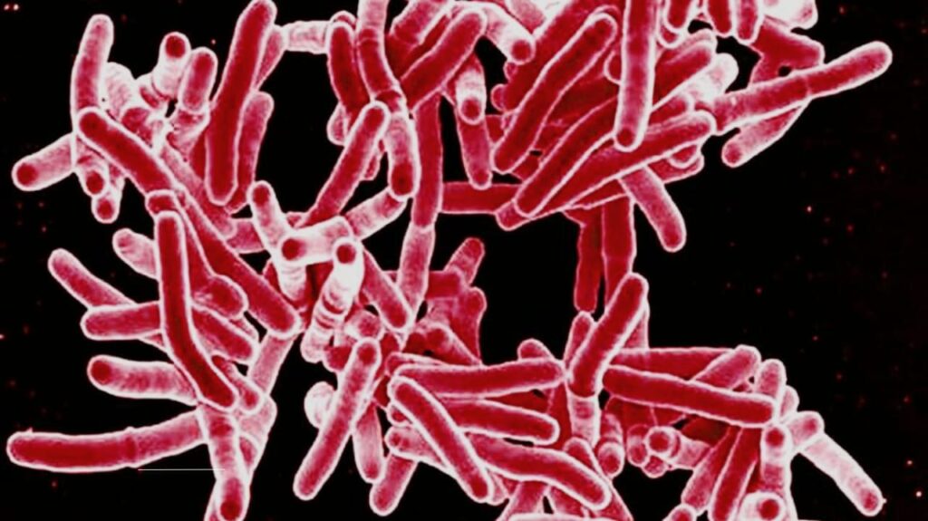 How to Protect Yourself from TB Exposure