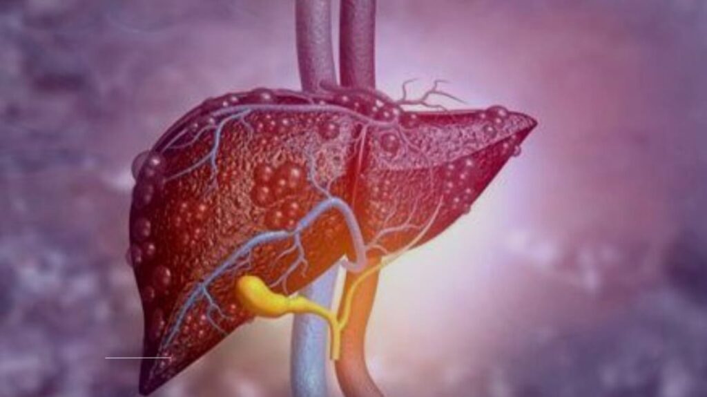 Hepatitis and Liver Damage: Stages, Risks, and Reversal Tips