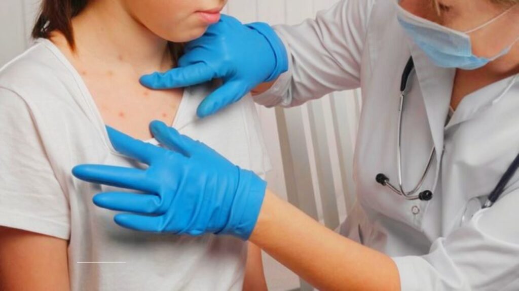 Measles Outbreaks in Kansas, Ohio, and Texas: How a Preventable Crisis Threatens Public Health