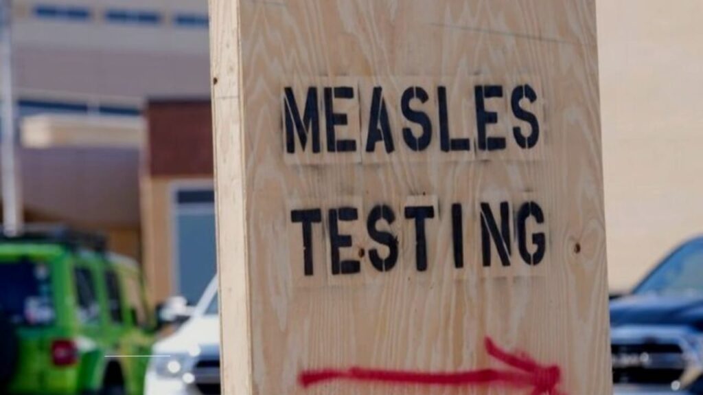 Measles Returns to New York: Why Health Experts Are Sounding the Alarm