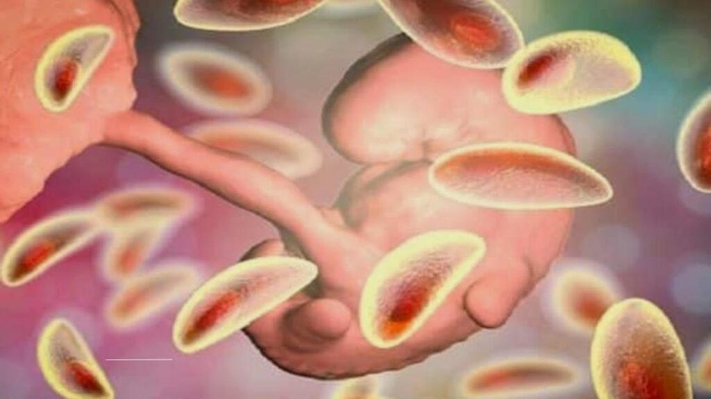 HIV Symptoms in Men: How to Recognize Early Warning Signs and Avoid Progression to AIDS