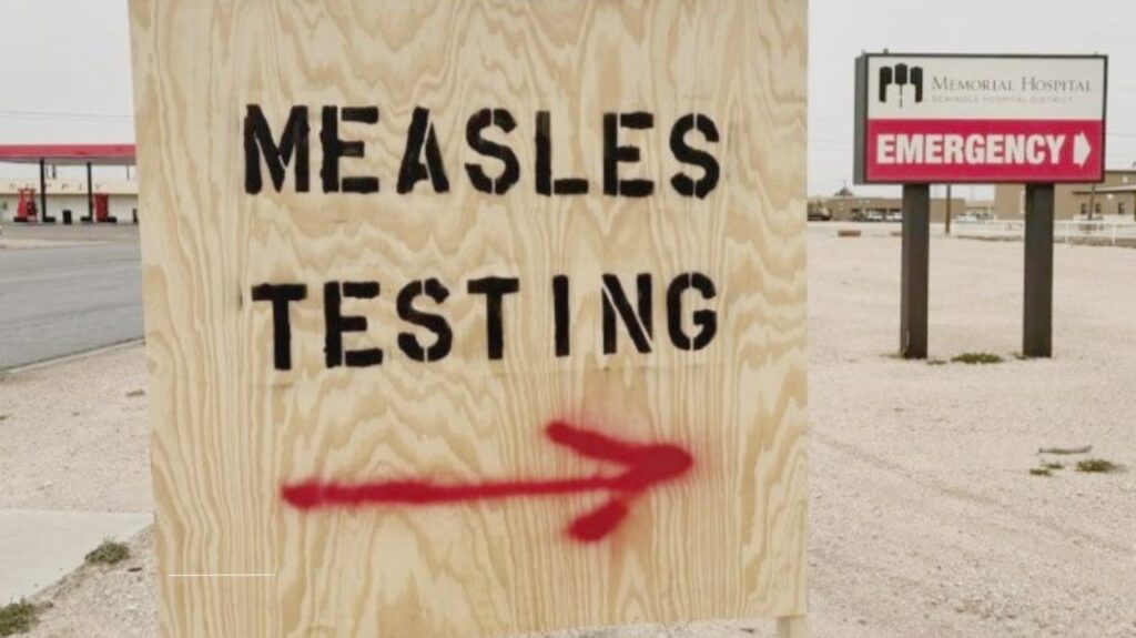 The Resurgence of Measles in Texas: A Public Health Alarm