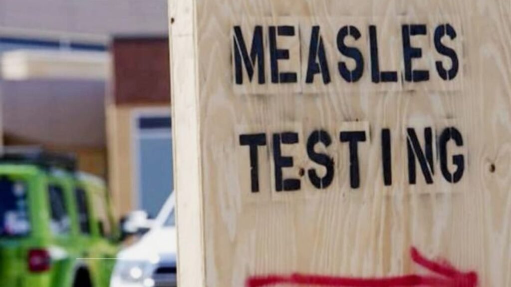 Measles Outbreaks in Texas: Rising Cases, Vaccine Hesitancy, and Public Health Challenges Explained  