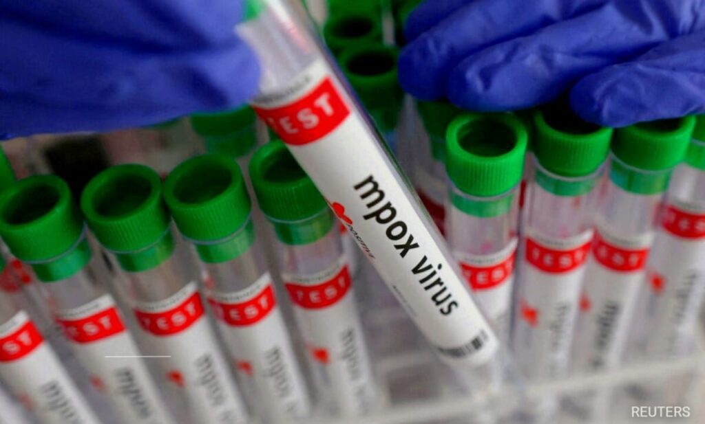 UK Health Authorities Probe Unexplained Mpox Cases: Transmission Risks and Public Health Response