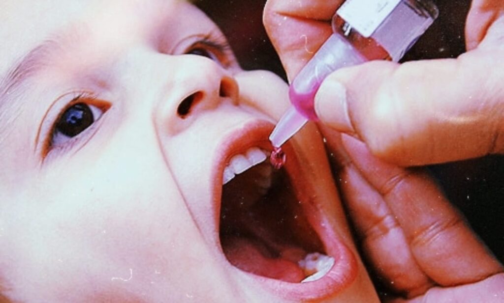 Polio in US Wastewater: Detection, Risks, and Public Health Strategies for Communities