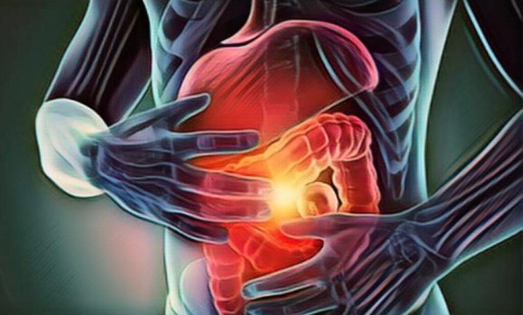 Pancreatic and Colorectal Cancer Surge in Young Adults: Unpacking Causes, Symptoms, and Prevention Strategies