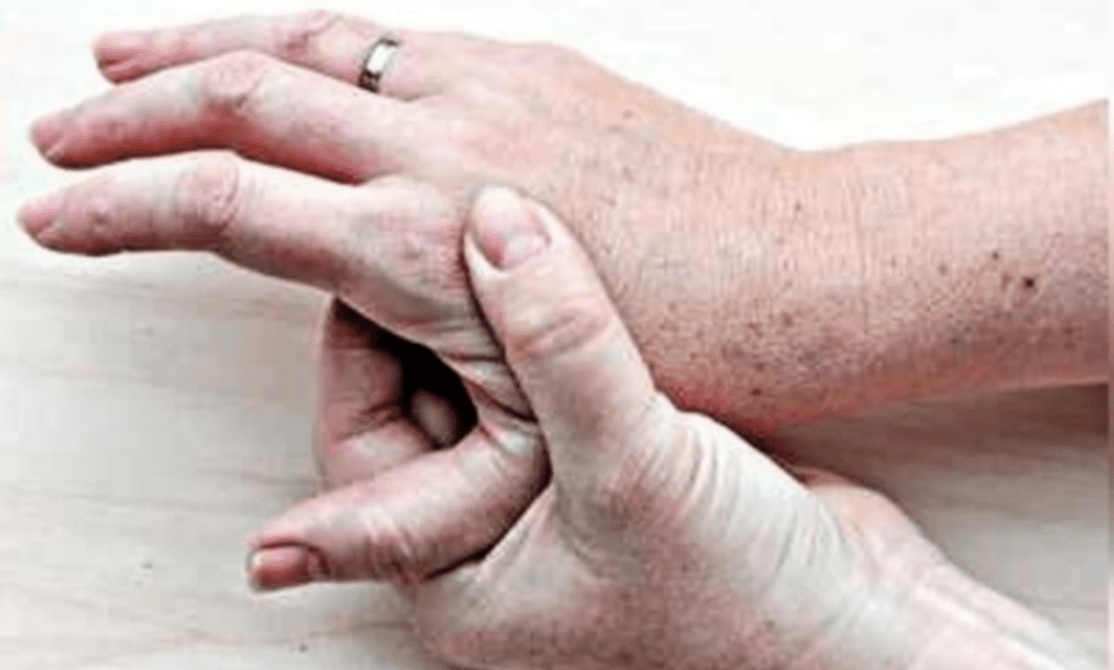 Vitamin B12 Deficiency Uncovered: Critical Signs, Hidden Dangers, and Your Action Plan