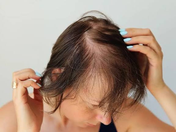 Hair Loss Solutions: Best Hair Loss Treatment for Men and Hair Loss Treatment for Women