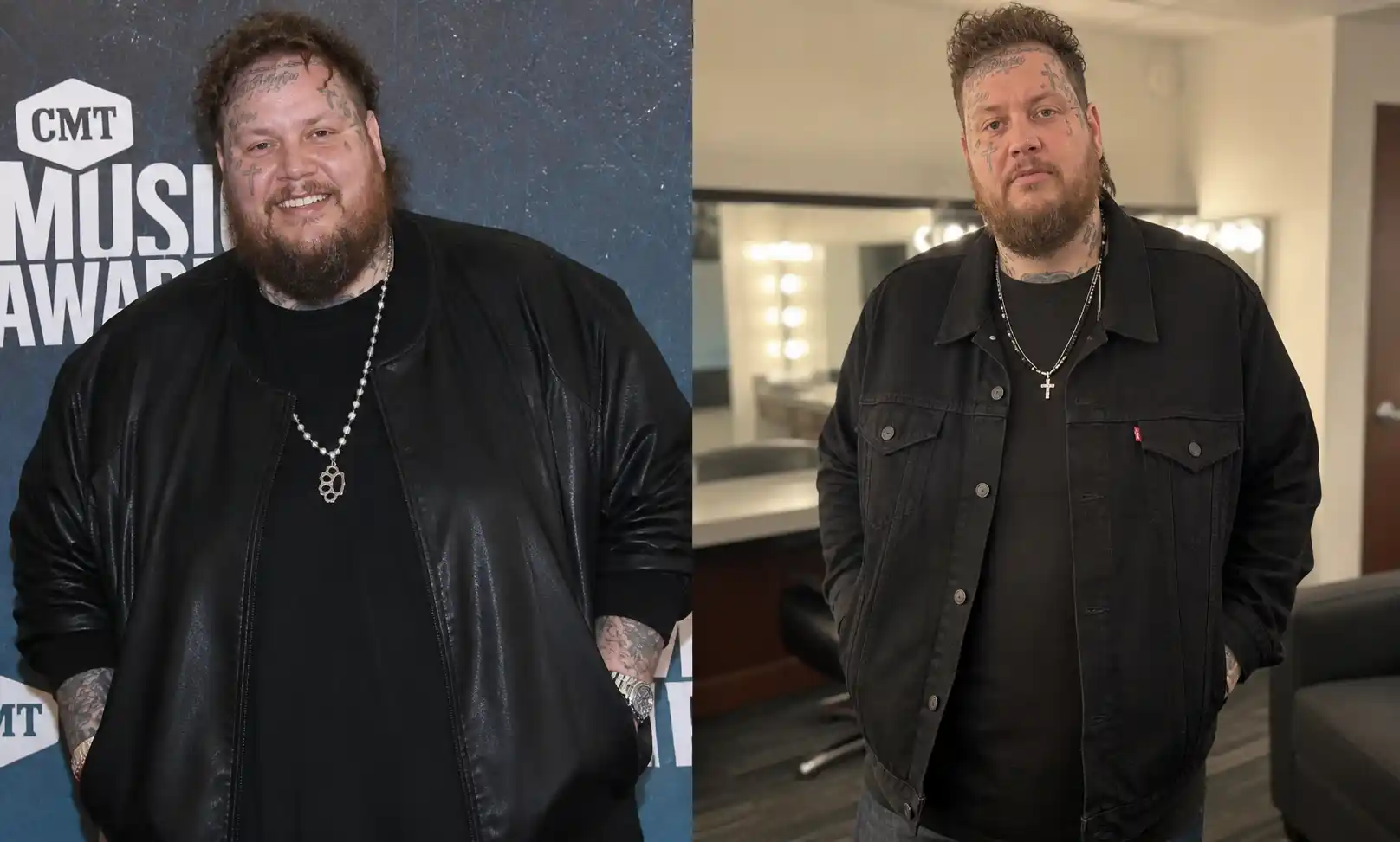 Jelly Roll Weight Loss: Real Story, Diet &amp; Transformation