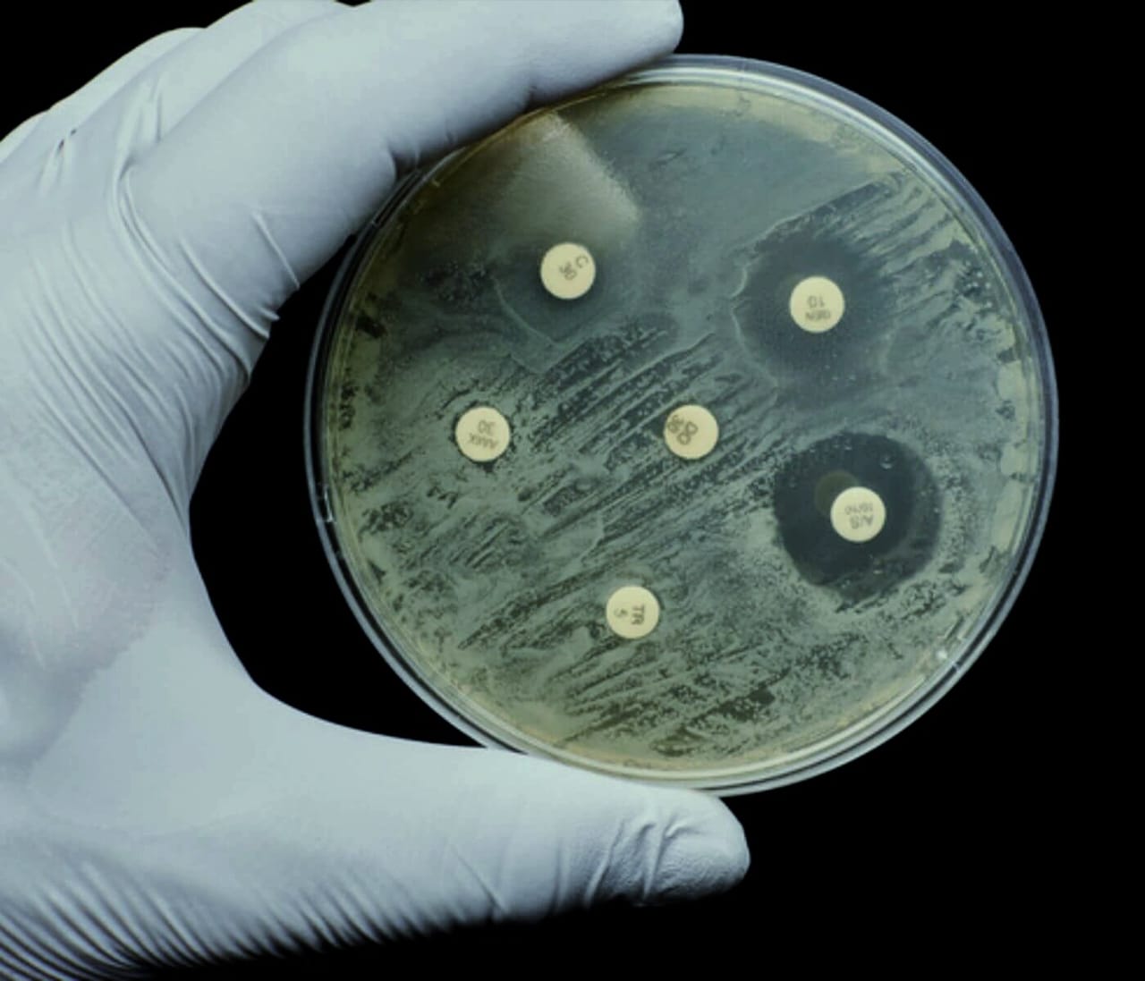 Antibiotic Resistance in Europe