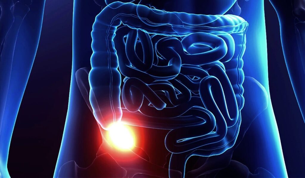 Pancreas organoid