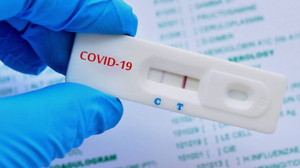 Covid-19 surge, XEC variant, respiratory viruses,