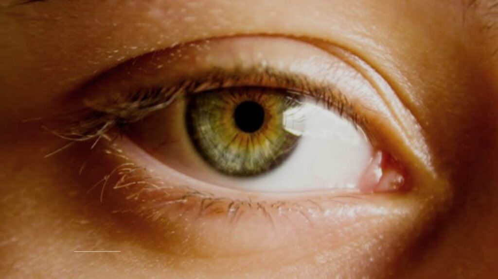 Hazel eyes
Eye color
Iris pigmentation
Genetics of hazel eyes
Color-shifting eyes
