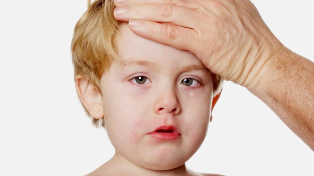 Child with Lyme disease symptoms after outdoor tick exposure.