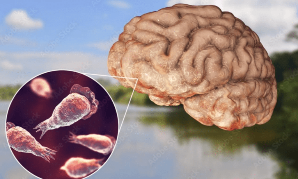 Southern lake brain-eating amoeba death and prevention steps.