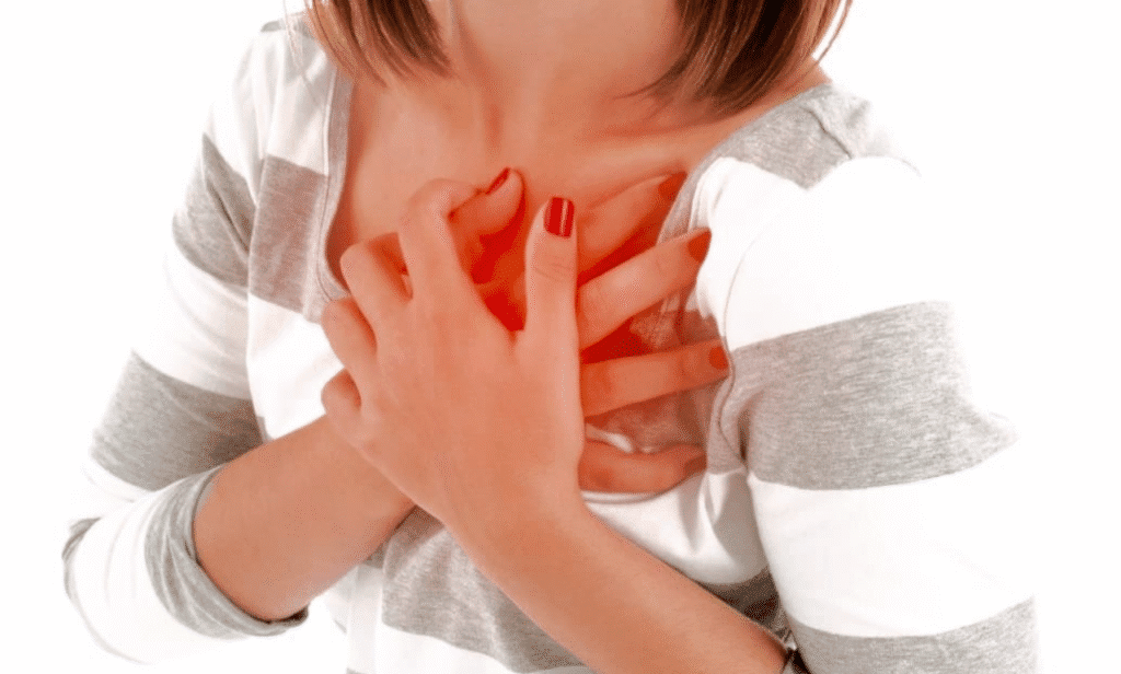 A diagram explaining SCAD heart attacks in women.