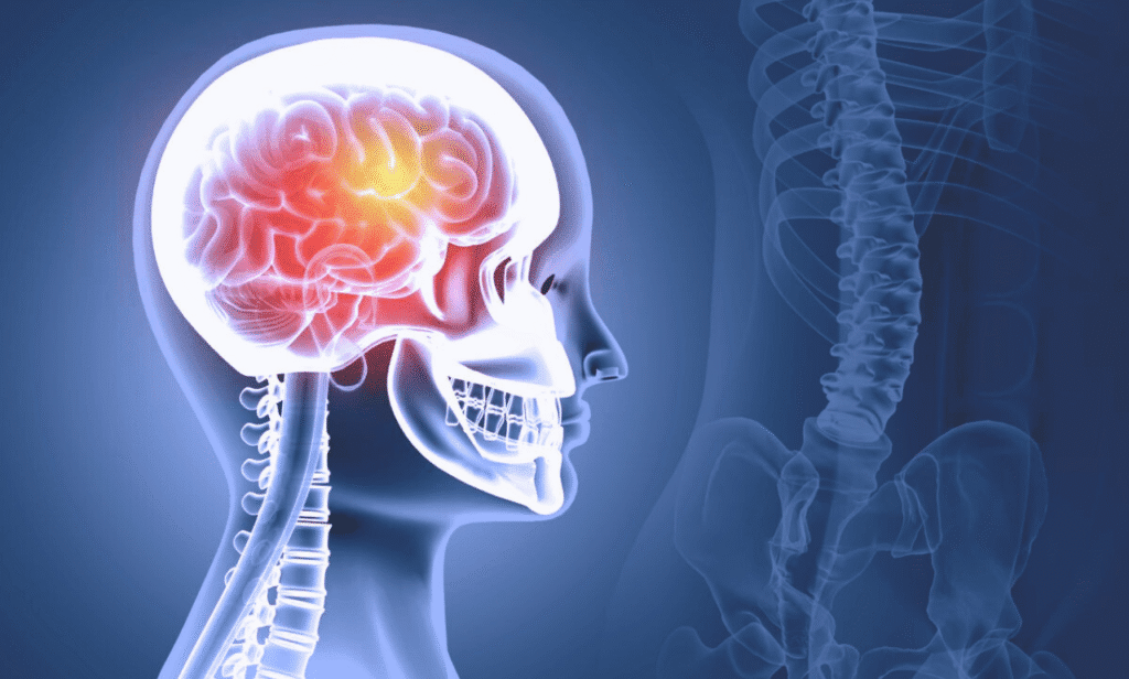  A new therapy bringing hope for Huntington's disease treatment.
