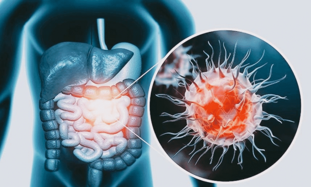 Young adults lowering colon cancer risk through lifestyle changes.
