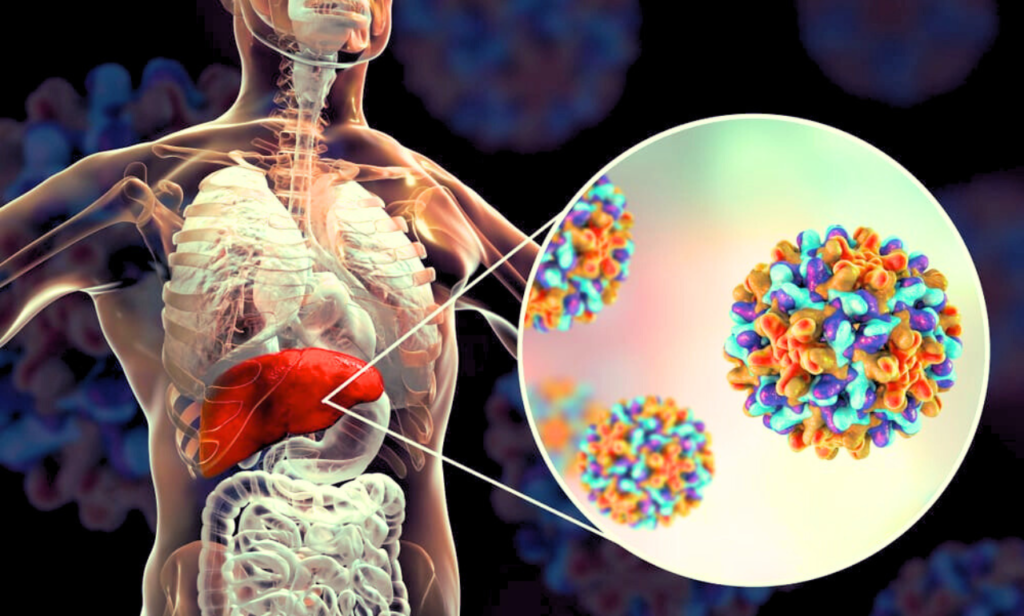 Hepatitis B test and treatment with vital self care